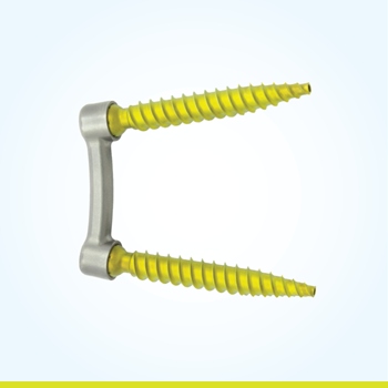 PressON Spinal Fixation System